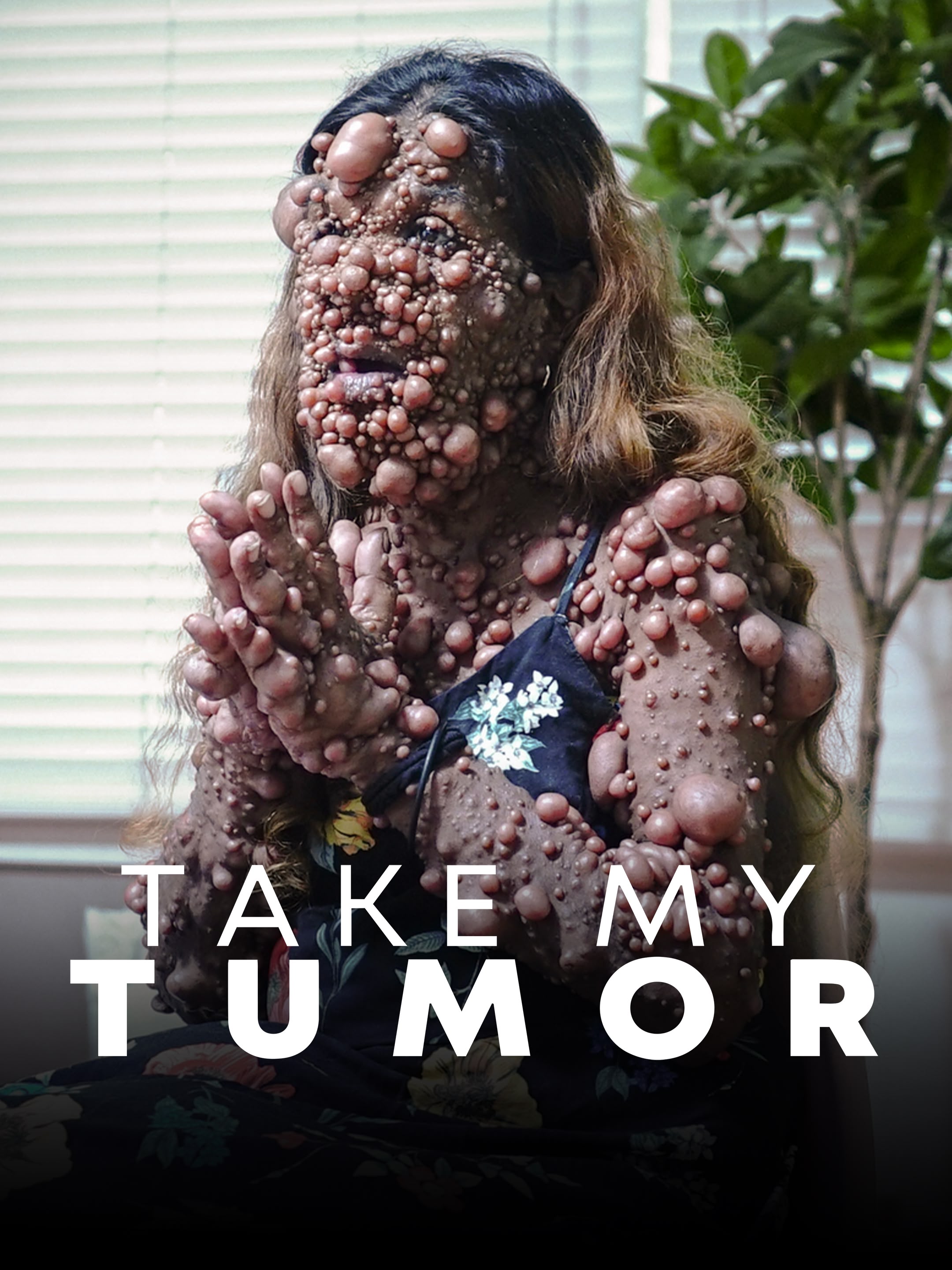 Take My Tumour