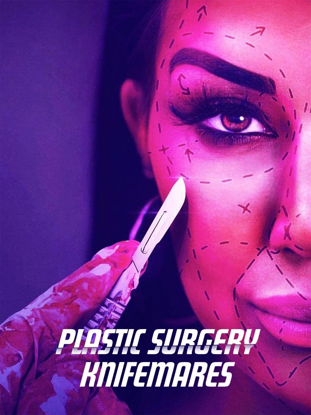 Plastic Surgery Nightmares